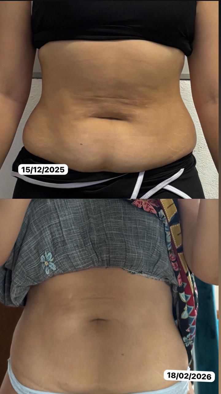 Antes e depois — 2 meses de treinamento